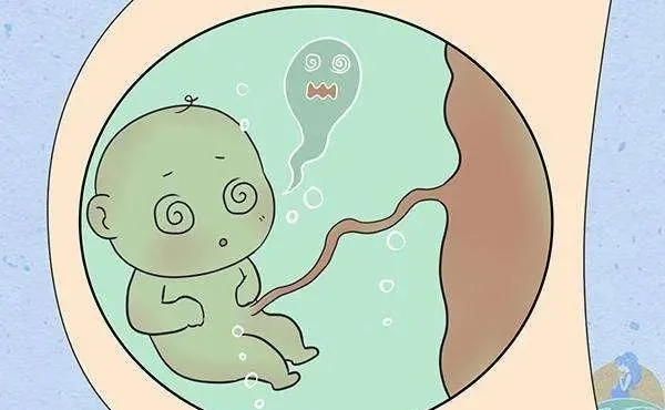 “羊水浑浊”是怎么回事?还可以顺产不?