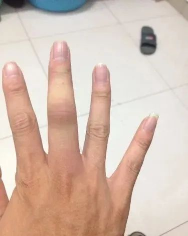 【健康科普】外伤的护理方法,您知道该怎么做吗?